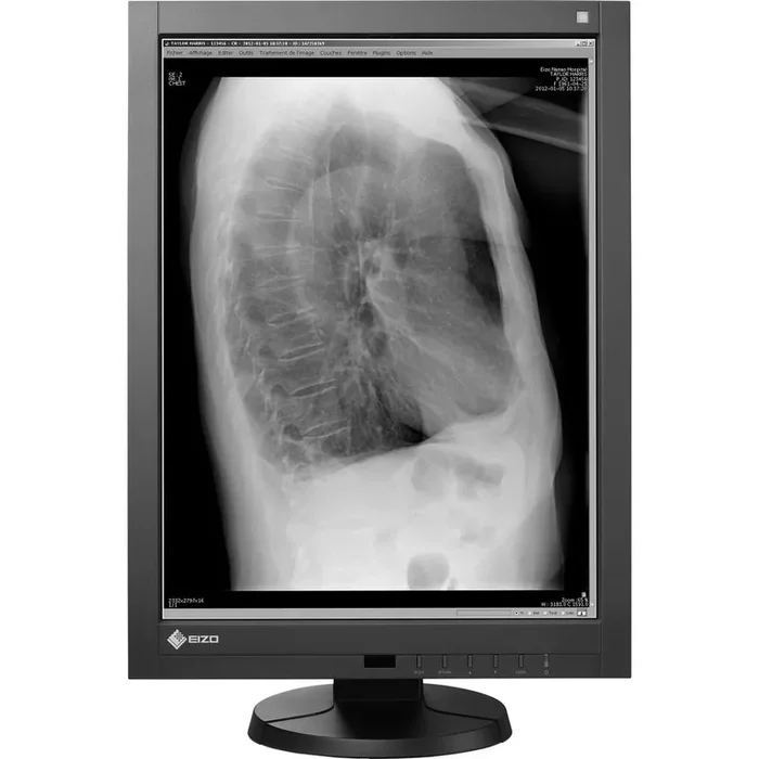 Eizo Radiforce Gx240-Cl-P 21.3″ Uxga Led Lcd Monitor – 4 3 – Black